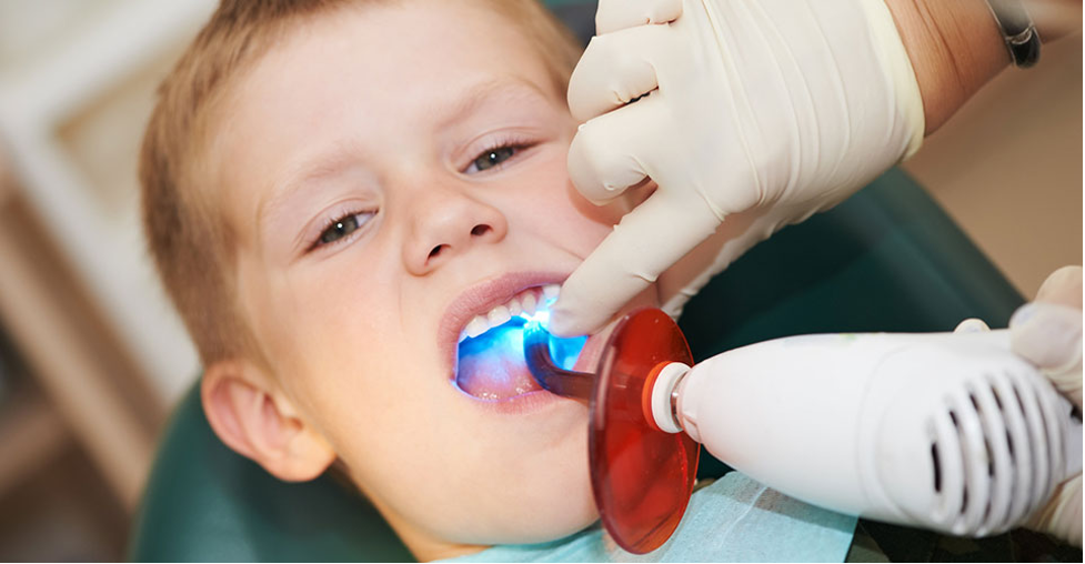 6 Ways to Prevent Cavities in Children