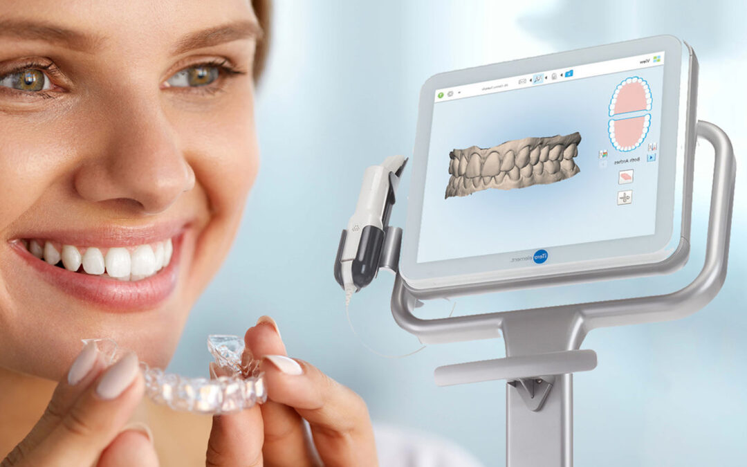 What are the benefits of digital Orthodontic scans?